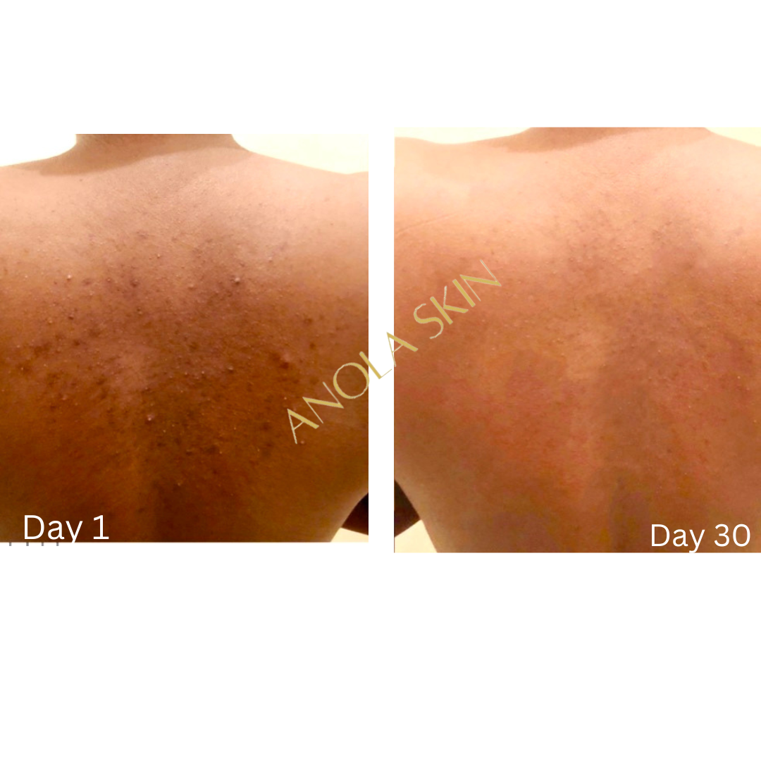 Double Cleansing Kit: Anti-Aging